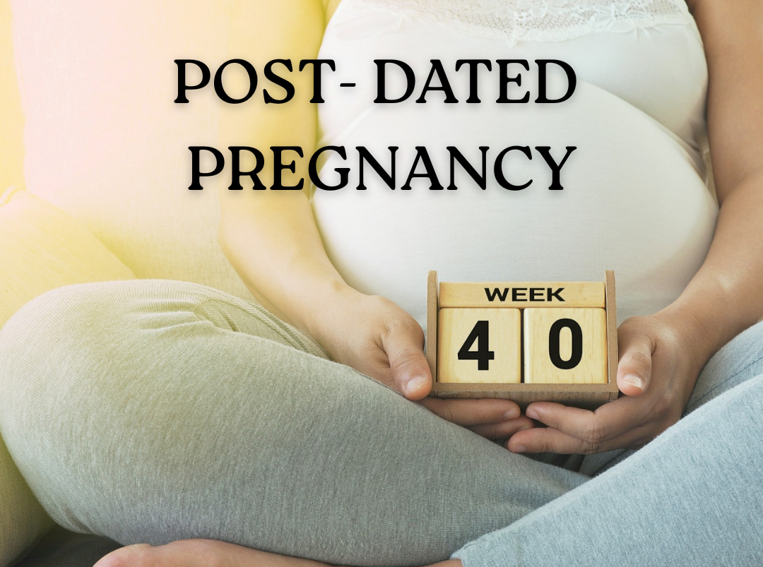 Post-Dated Pregnancy